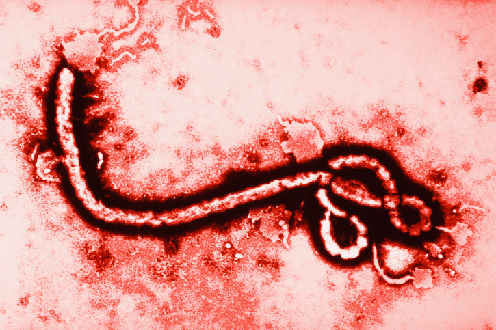 Ebola Virus at 108000 Magnification Photo FuseThinkstock 2013
