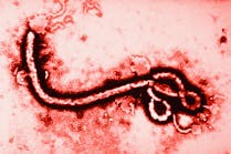 Ebola Virus at 108,000 Magnification. Photo: Fuse/Thinkstock 2013