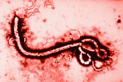 Ebola Virus at 108000 Magnification Photo FuseThinkstock 2013 Ebola Virus at 108000 Magnification Photo FuseThinkstock 2013