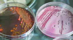 Bacteria in petri dishes