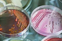 Bacteria in petri dishes Bacteria in petri dishes