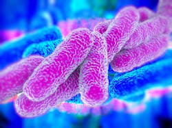 Legionella Large 963x722 64b9679150845 Legionella Large 963x722 64b9679150845