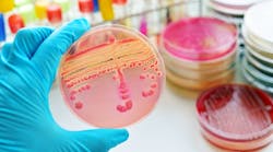 Colonies of bacteria in culture medium plate Colonies of bacteria in culture medium plate
