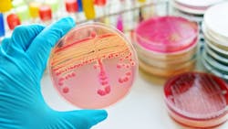 Colonies of bacteria in culture medium plate Colonies of bacteria in culture medium plate