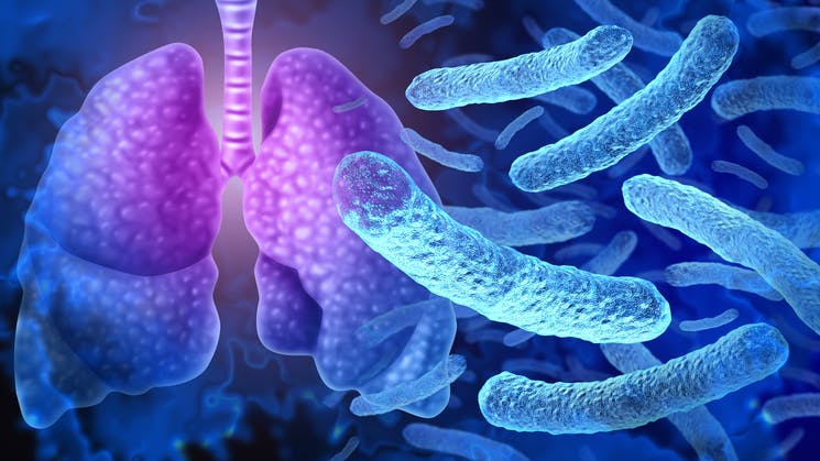 Legionella pneumophila bacteria outbreak and respiratory illness