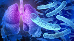 Legionella pneumophila bacteria outbreak and respiratory illness